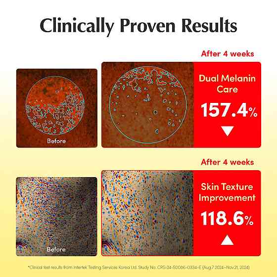 EQQUALBERRY Vitamin Illuminating Serum | Niacinamide 4% + Brightening Vitamin C Face Serum with Hyal Richmond