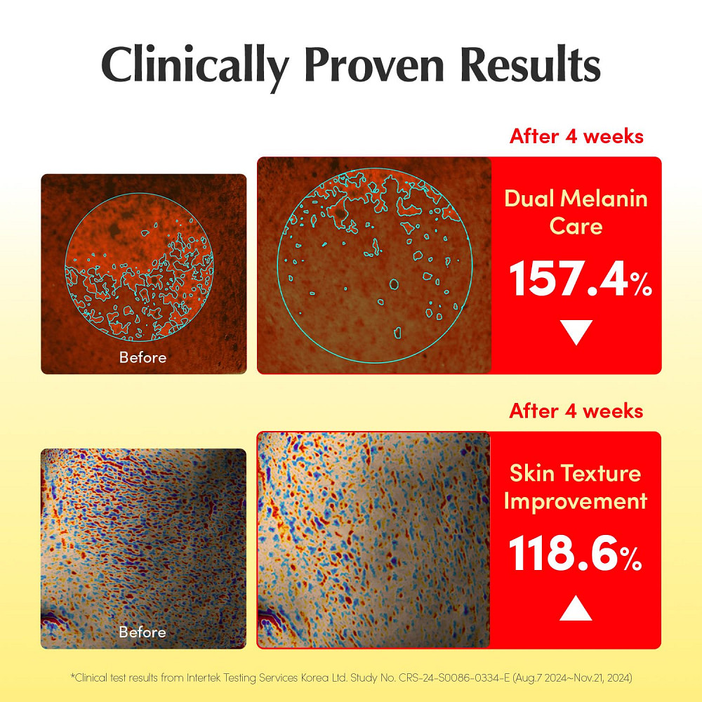 EQQUALBERRY Vitamin Illuminating Serum | Niacinamide 4% + Brightening Vitamin C Face Serum with Hyal Richmond - photo 5