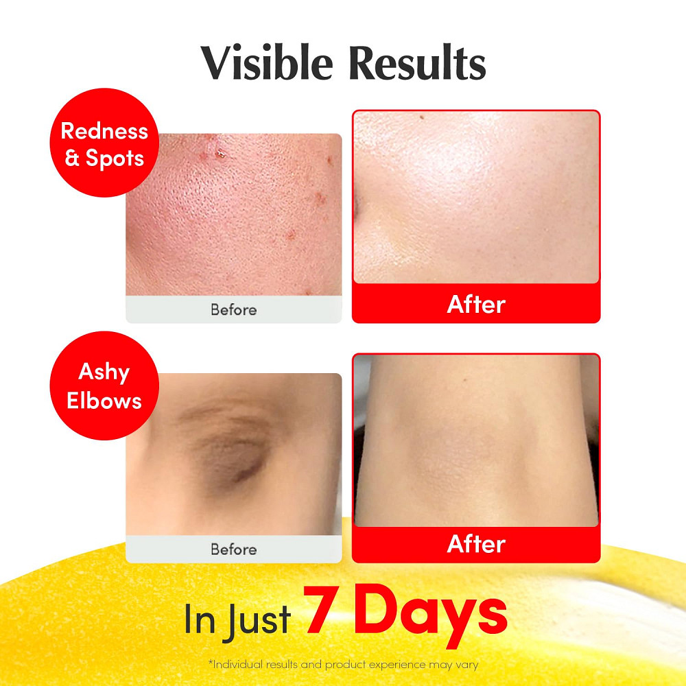 EQQUALBERRY Vitamin Illuminating Serum | Niacinamide 4% + Brightening Vitamin C Face Serum with Hyal Richmond - photo 4