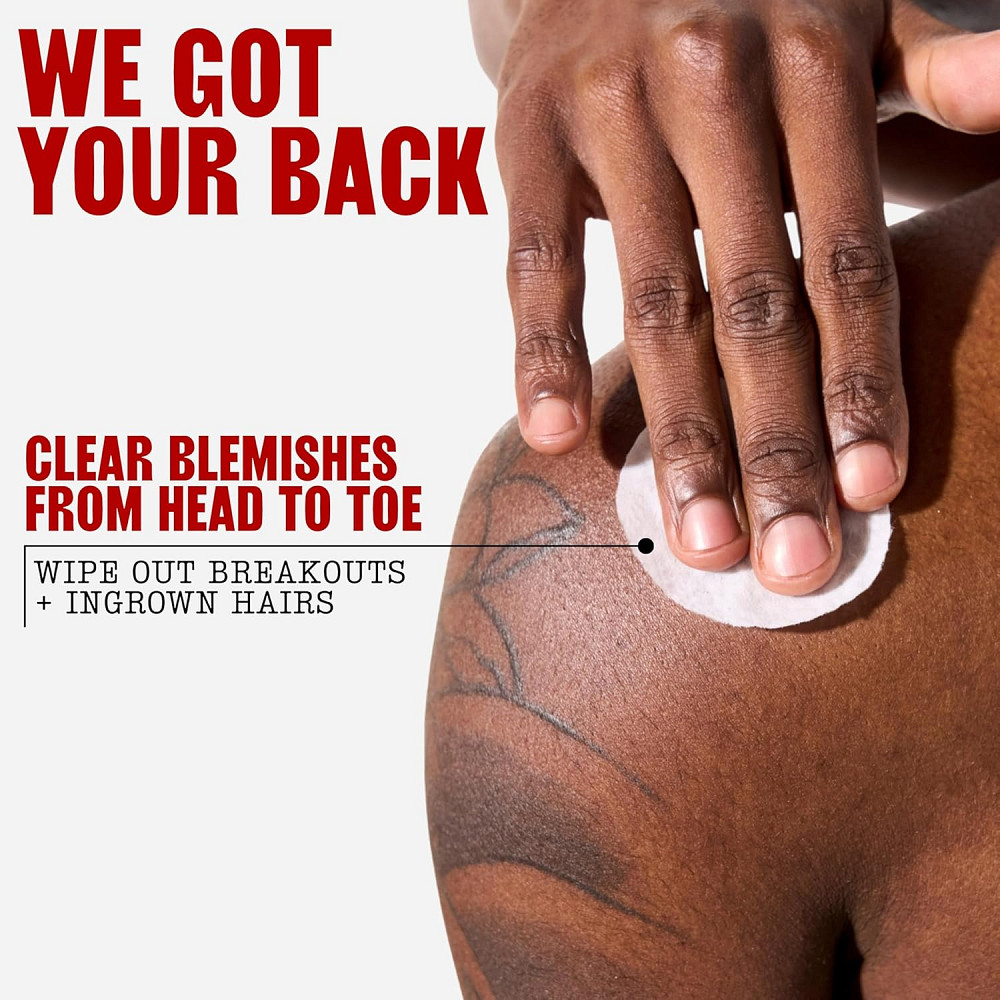 Thayers Blemish Clearing Acne Pads, Salicylic Acid Acne Treatment for Face, Pore Reducing, Exfoliati Richmond - photo 8