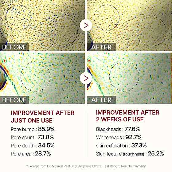 Dr.Melaxin Peel Shot Glow Black Rice Peeling Ampoule 80ml, Dead Skin Remover Gentle Exfoliating with Richmond