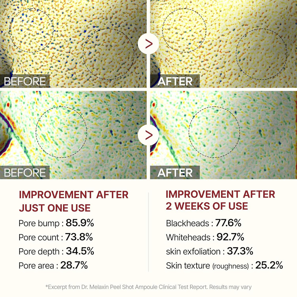 Dr.Melaxin Peel Shot Glow Black Rice Peeling Ampoule 80ml, Dead Skin Remover Gentle Exfoliating with Richmond - photo 6