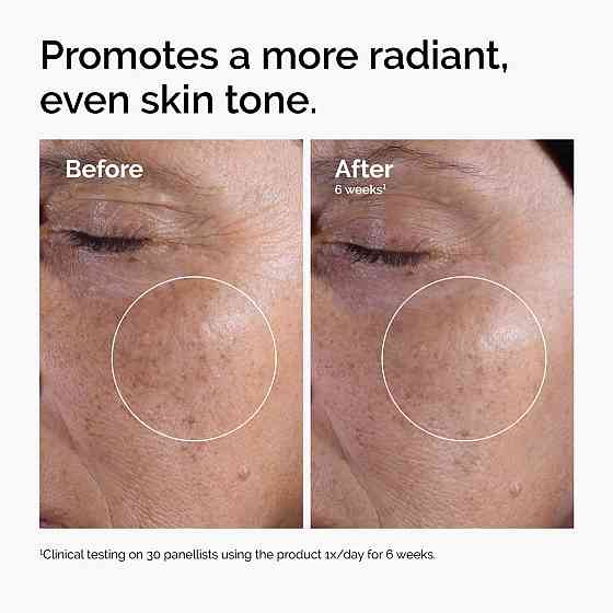 The Ordinary Glycolic Acid 7% Exfoliating Toner, Brightening and Smoothing Daily Toner for More Even Richmond