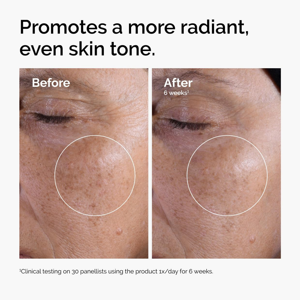 The Ordinary Glycolic Acid 7% Exfoliating Toner, Brightening and Smoothing Daily Toner for More Even Richmond - photo 2