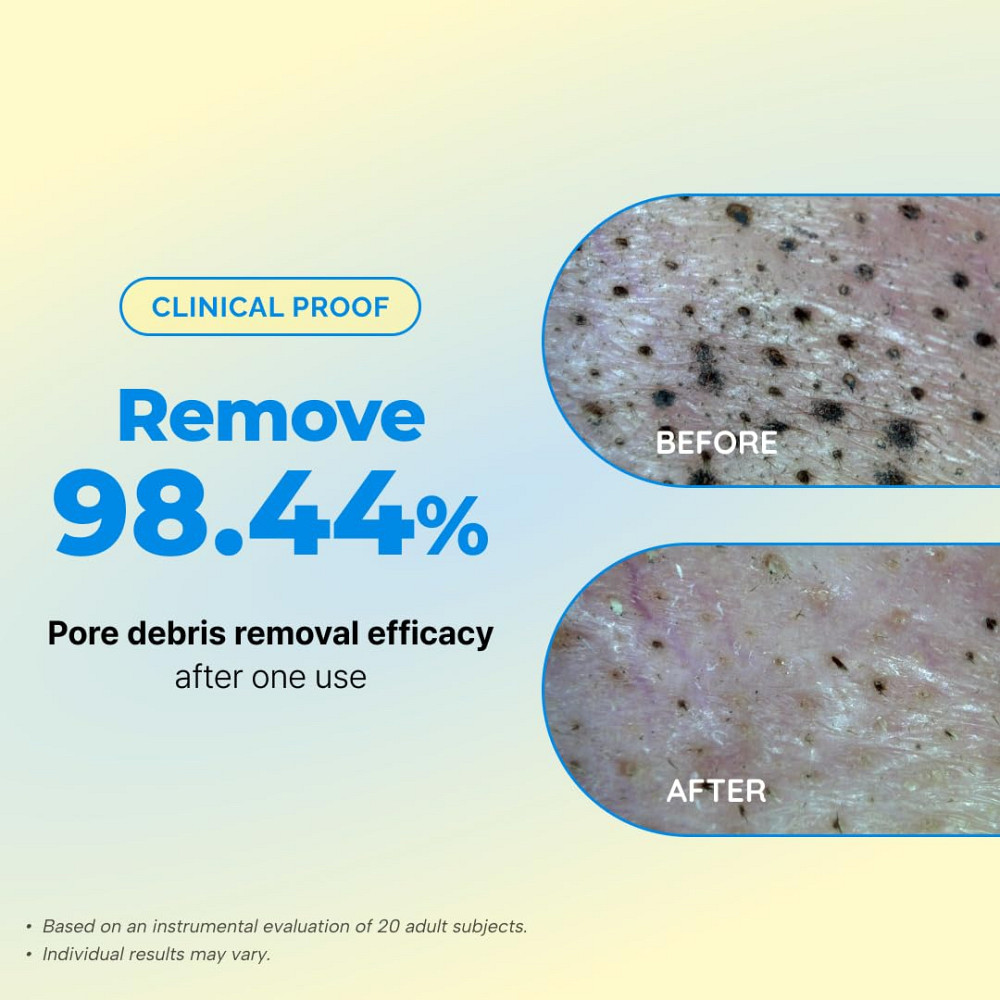 Dr.Eve Seedlab Seed& Rice Glow Reset Cleanser - Korean Rice Face Wash for Exfoliating, Deep Cleansin Richmond - photo 4