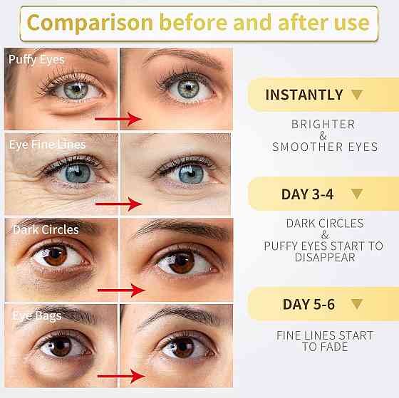 24K Gold Under Eye Patches - 60 Pack for Puffy Eyes, Dark Circles, Bags & Wrinkles with Collagen & H Richmond