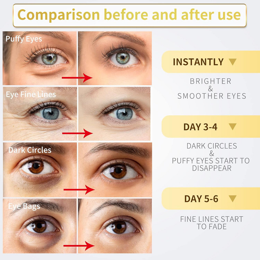 24K Gold Under Eye Patches - 60 Pack for Puffy Eyes, Dark Circles, Bags & Wrinkles with Collagen & H Richmond - photo 3